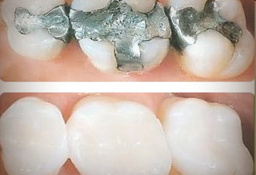 Restorative Dentistry